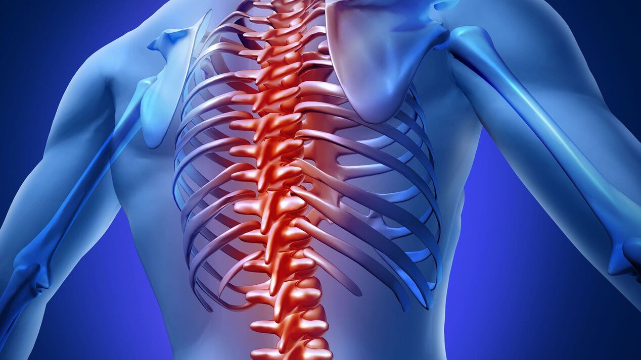 Torakal osteokondroz